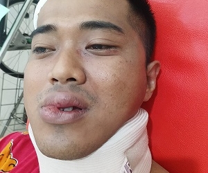 Berharap Terungkap Pelaku Pemukulan, Keluarga Yosca: Atau Keluarkan SP3 Agar Jumpa di Pra Peradilan
