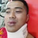 Berharap Terungkap Pelaku Pemukulan, Keluarga Yosca: Atau Keluarkan SP3 Agar Jumpa di Pra Peradilan