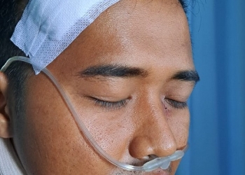 Keluarga Yosca Harap Polisi dapat Ungkap Pemukulan yang Terjadi di Rasa Yakin