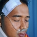 Keluarga Yosca Harap Polisi dapat Ungkap Pemukulan yang Terjadi di Rasa Yakin