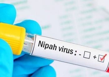 Penyakit yang Ditularkan Hewan ke Manusia, DP3 Imbau Masyarakat Waspada Virus Nipah