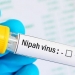 Penyakit yang Ditularkan Hewan ke Manusia, DP3 Imbau Masyarakat Waspada Virus Nipah